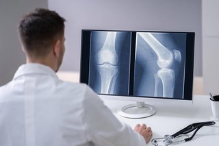 Arzt begutachtet Röntgenaufnahme eines Knies
