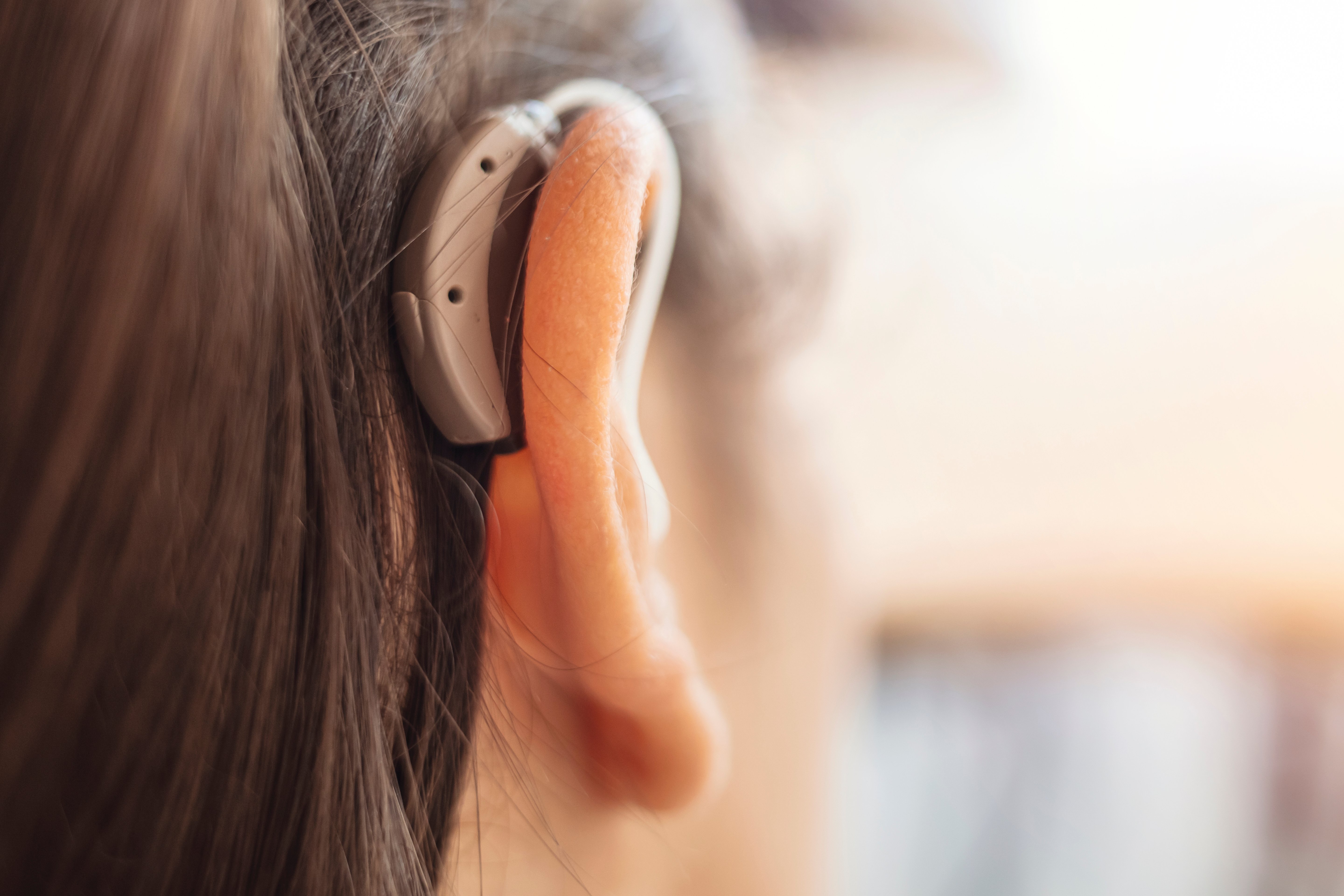 Hörgerät-Versorgung Kopf einer Frau mit einem Hörgerät hinter dem rechten Ohr.