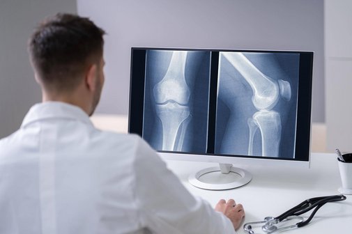 Arzt begutachtet R&ouml;ntgenaufnahme eines Knies