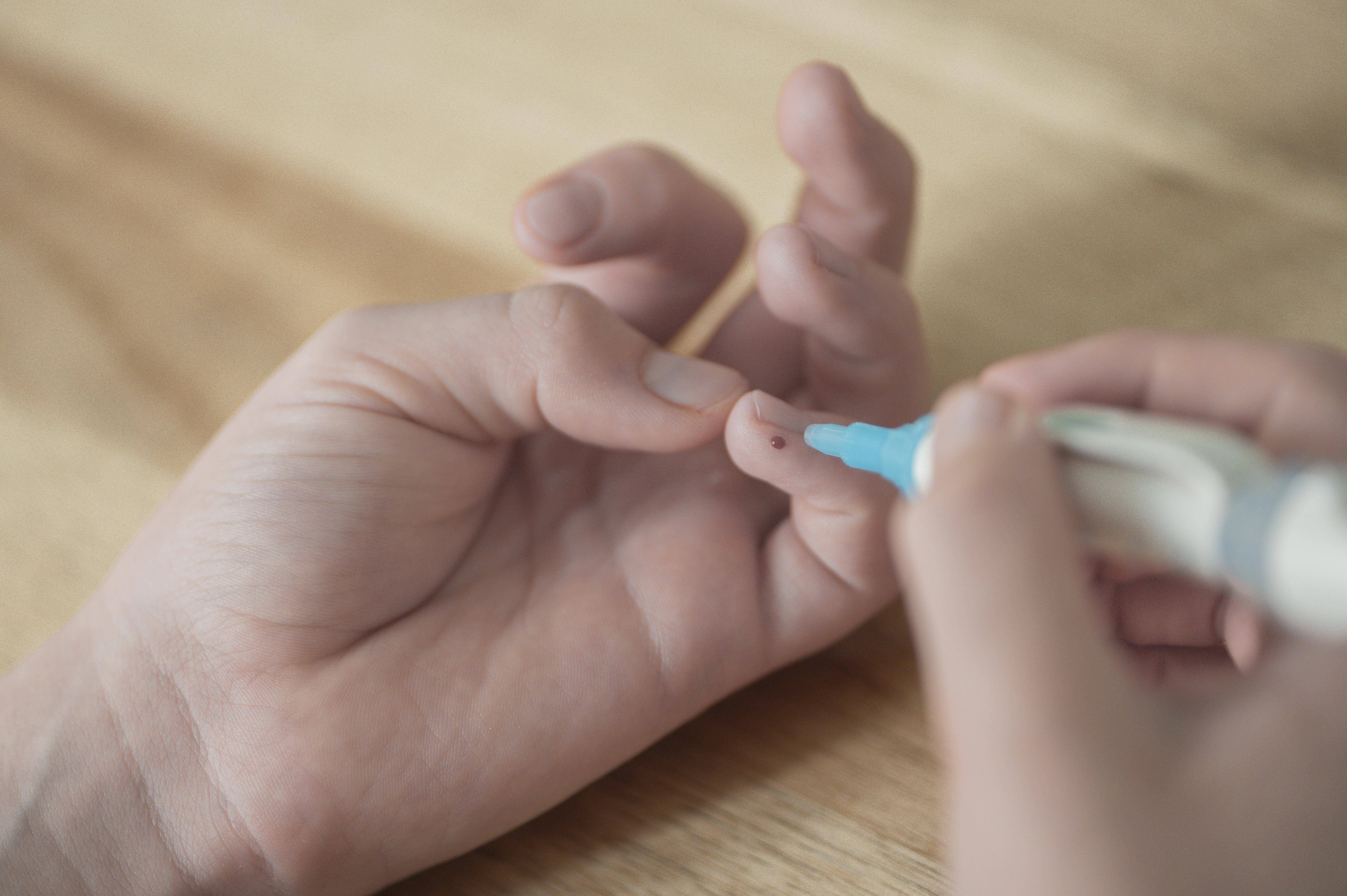 Blutzuckermessung bei einem Kind Das Bild zeigt eine Kinderhand, deren kleiner Finger einen Tropfen Blut zeigt. In der rechten Hand hält das Kind die Lanzette als Stechhilfe, hat sich gerade gepiekst, um den Blutzucker zu bestimmen.