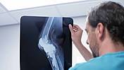 Ein Arzt schaut sich die Röntgen-Aufnahme eines Knies an.