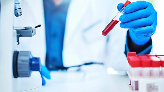 Untersuchung einer Blutprobe im Labor